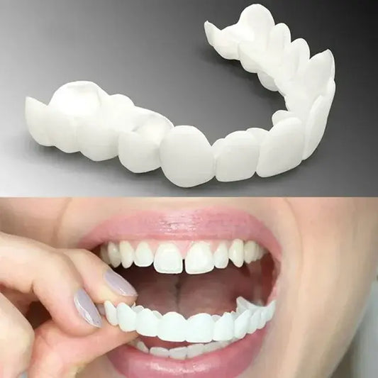 GLOW™ Adjustable Snap-On Dentures